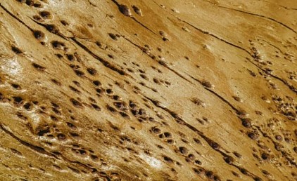termite treatment Sydney